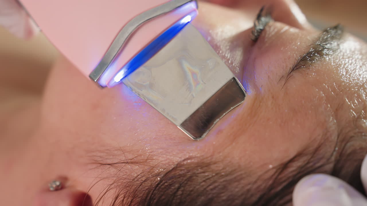 Close up of female specialist gliding ultrasonic spatula across facial skin to extract pimples from client during spa treatment showcasing precision under natural lighting for skin rejuvenation