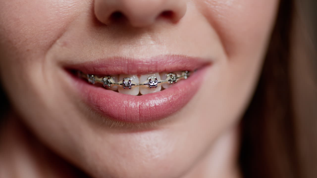 Woman with braces smiling