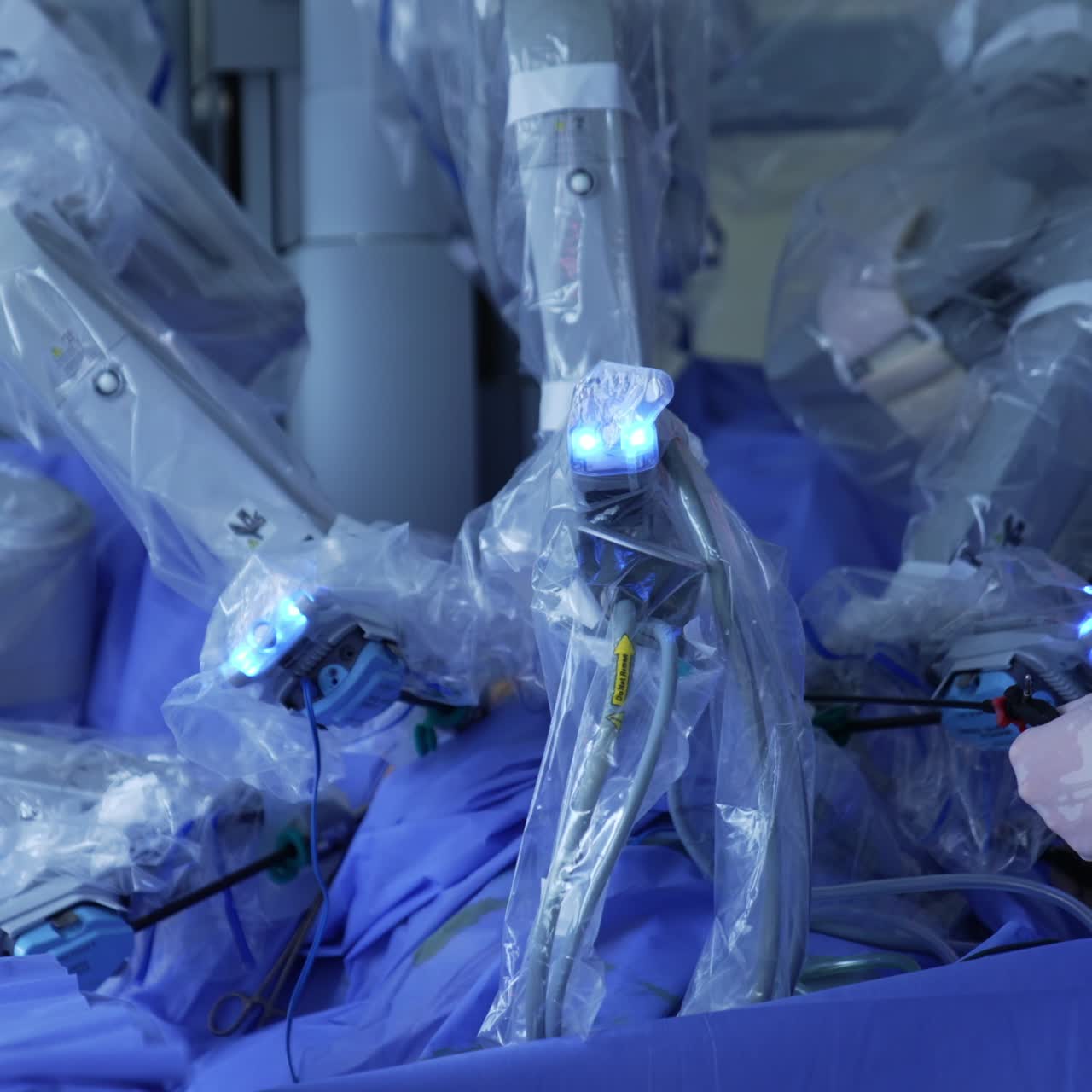 Surgeon cooperating with robotic equipment at modern surgery. Robotic arms in plastic moving slowly while doctor holding a tool