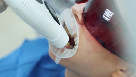 teeth whitening procedure in a dental clinic. the girl is wearing red uv safety glasses. visit to the dentist