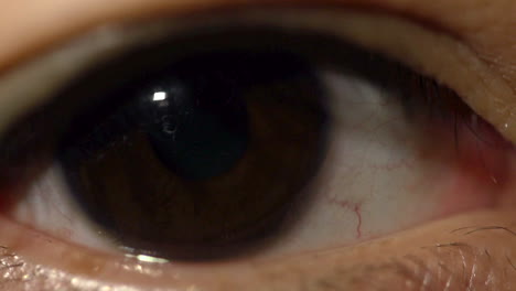 acercamiento de un ojo con su pupila dilatada