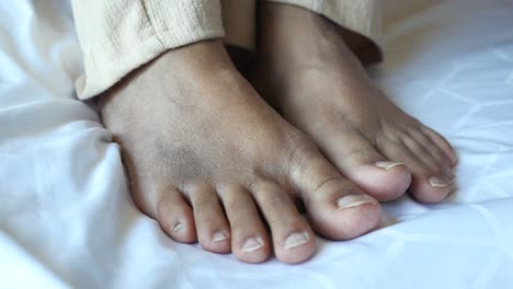 dry, cracked feet on a bed