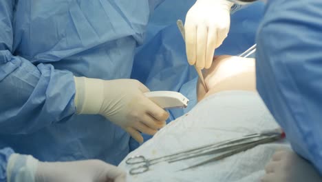 breast augmentation under the guidance surgeons team in surgical operating room