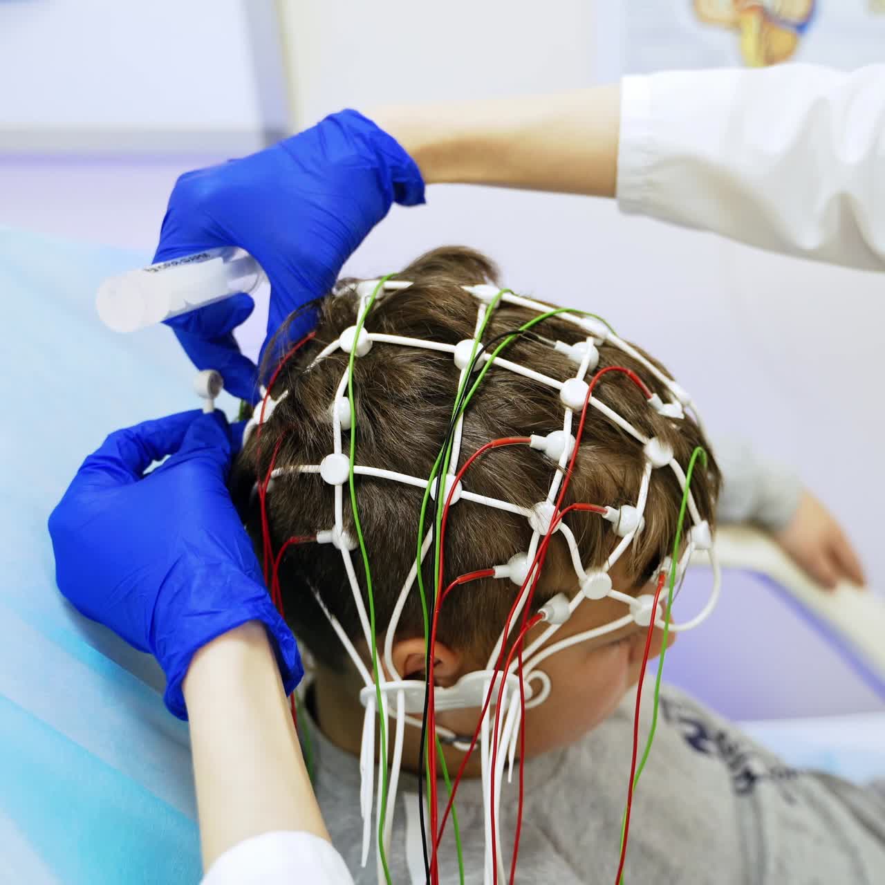 Teenage boy sits in white chair at doctor's cabinet. Medic in blue latex gloves attaches electrodes to a kid's head for EEG testing. Top view