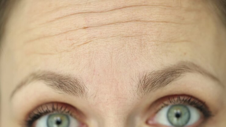 Close-up of a woman&#039;s face showing forehead and eyes
