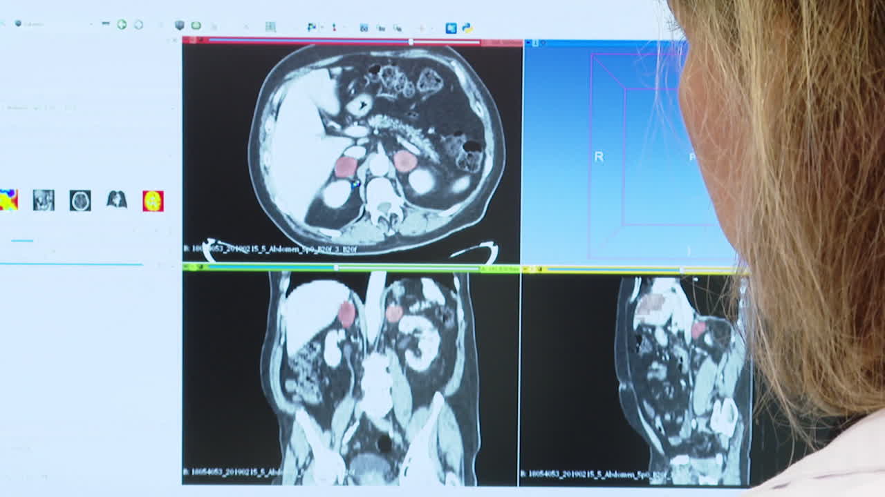 Medical professional reviewing CT scan images