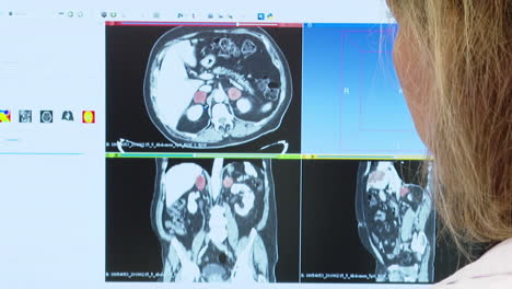 medical professional reviewing ct scan images