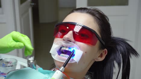 Young-woman-with-an-expander-in-mouth-and-red-protective-glasses-getting-UV-whitening-at-the-dentist's-office-by-an-ultra-violet-machine.-Shot-in-4k