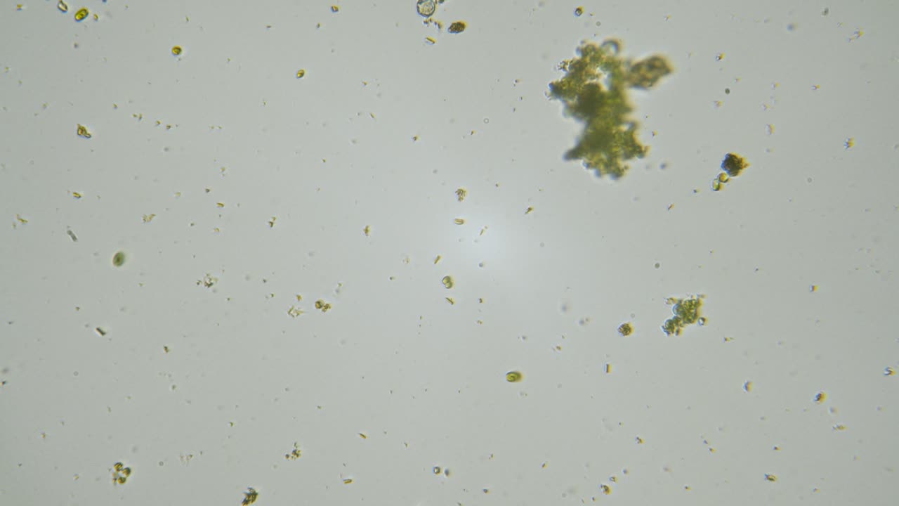 organismos unicelulares y algas bajo microscopio de aumento muestra de agua dulce