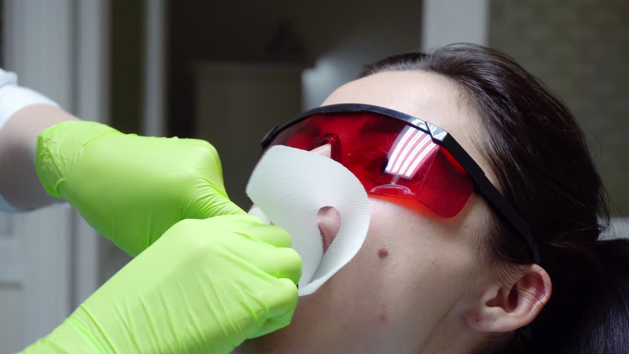 Closeup view of the dentist's hands putting rubber dam in a mouth of a female patient. Shot in 4k