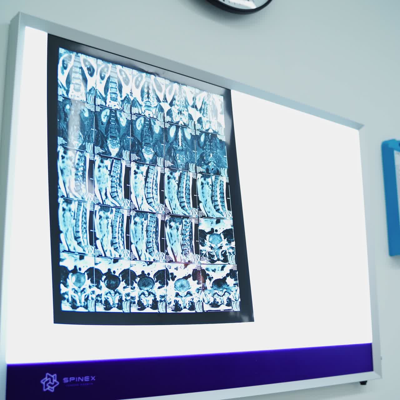 X-ray shot of patient