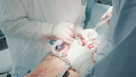 surgeon with assistant operates patient. woman doctor uses endoscopic equipment monitoring condition of coronary arteries during surgery in hospital