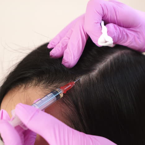 needle mesotherapy. cosmetologist makes injections into the scalp. thrust to strengthen hair and their growth