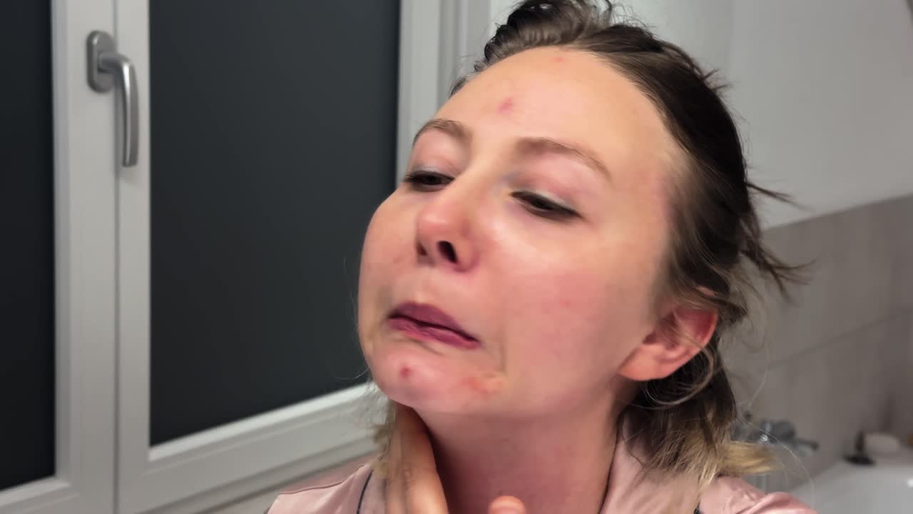 Primo piano di una donna che esamina i brufoli sulla fronte allo specchio, evidenziando le preoccupazioni per la cura della pelle, l'acne e la routine di cura personale. Ideale per concetti di bellezza, dermatologia e salute.