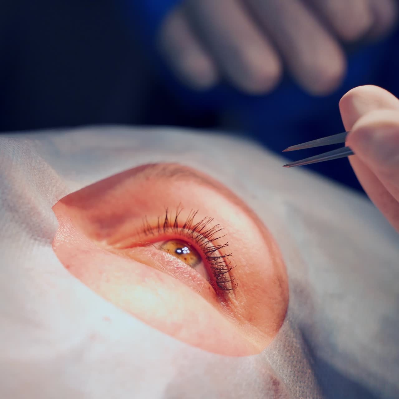 Patient eye treatment