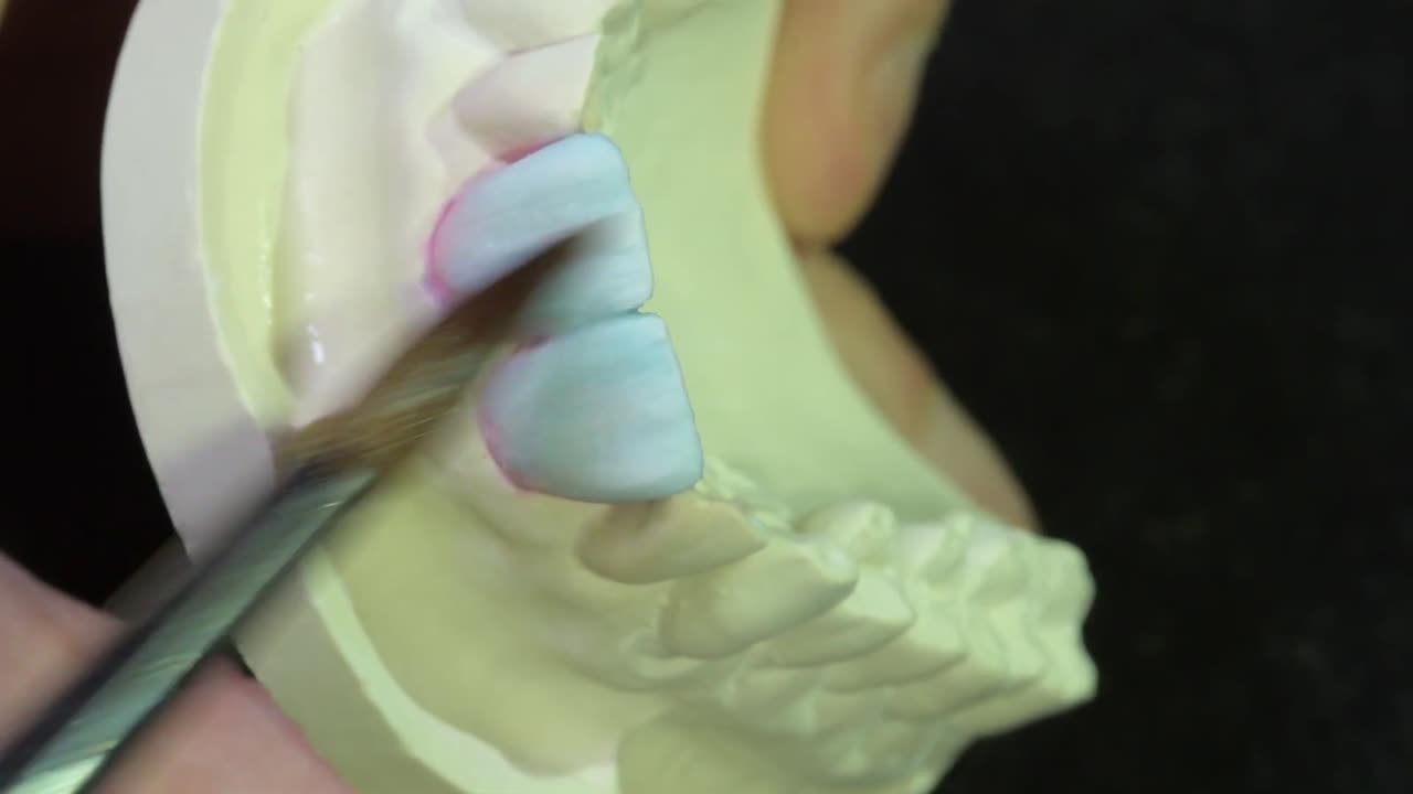 formas y contornos de técnicos dentales capas de coronas de cerámica en fundición de yeso, con precisión, delicadeza y gran atención a los detalles