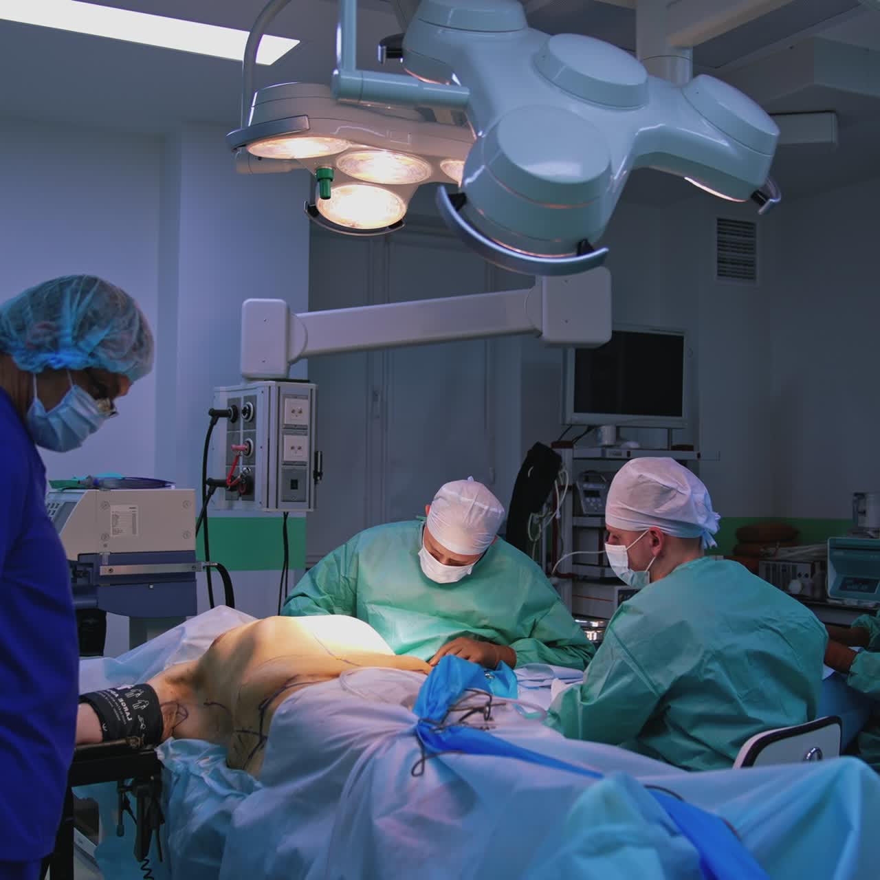 Team of doctors doing a plastic surgery. Patient on the operating table. Group of medical specialists performing a surgical procedure in clinic