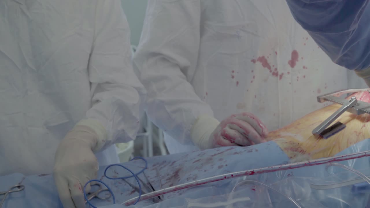 Medical staff of the operating unit do heart surgery
