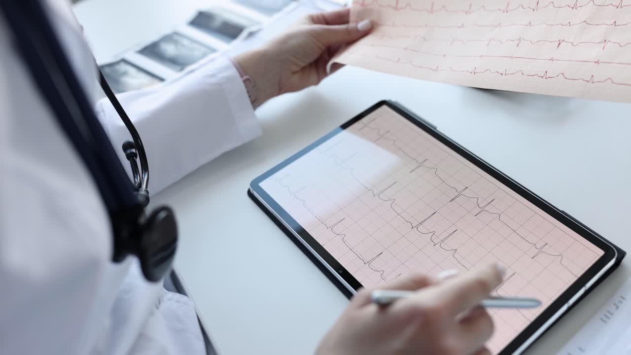 Cardiologista examina o eletrocardiograma do paciente em tablet close-up