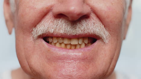 closeup macro shot of senior elderly man grandpa smiling showing yellow teeth dental problem