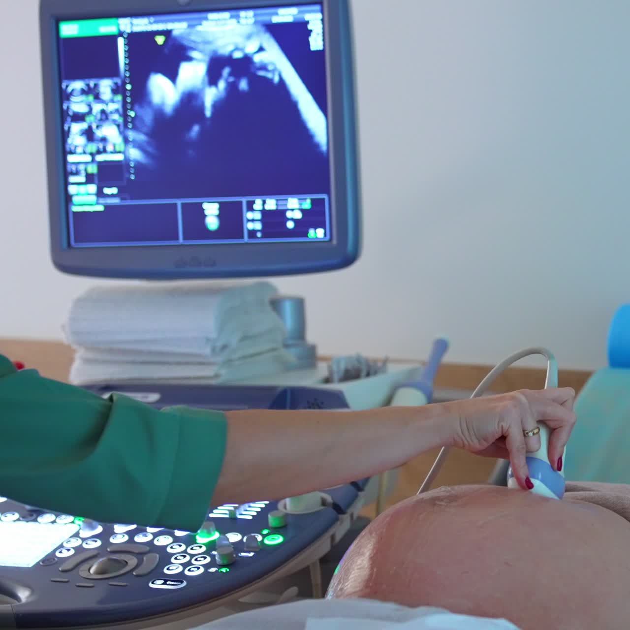 Woman at last months of pregnancy lies on the couch of a doctor. Obstetrician does the check up at ultrasound apparatus