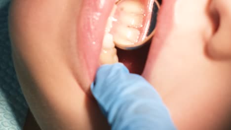 examen dental de un niño