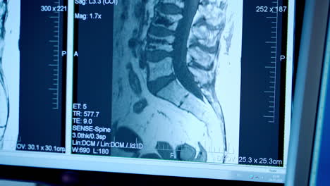 neurologist working on personal computer. medical scientist working with scan images
