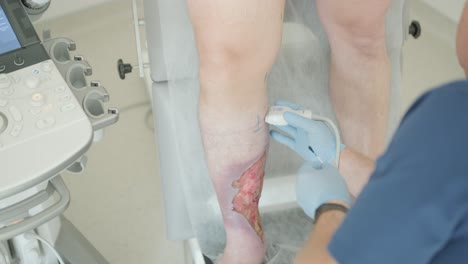 ultrasound examination of leg ulcer in medical clinic