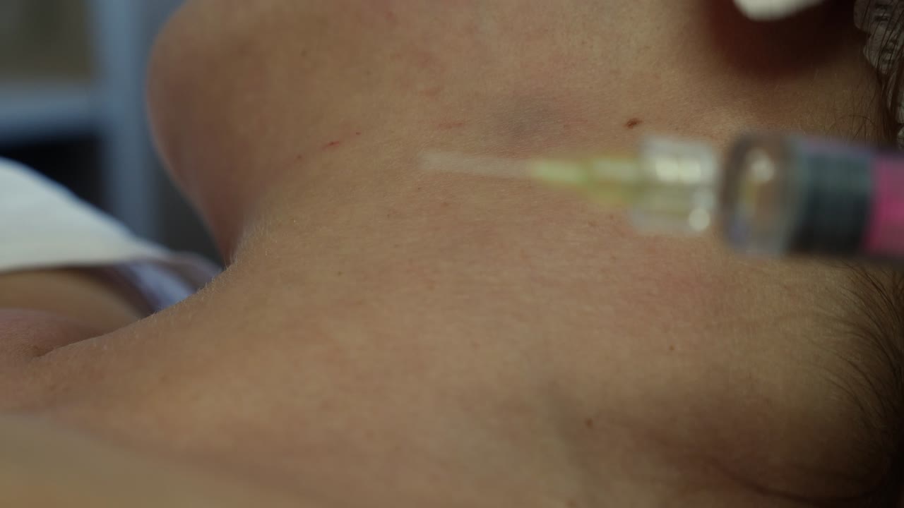 Cosmetic Injection on Neck