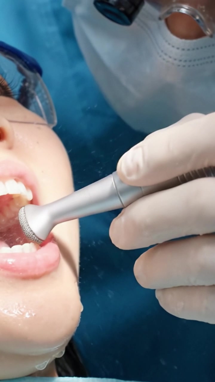 Precision Dental Procedure: A Close-Up of a Dental Professional Using a High-Tech Tool During an Oral Examination for Patient Care and Comfort