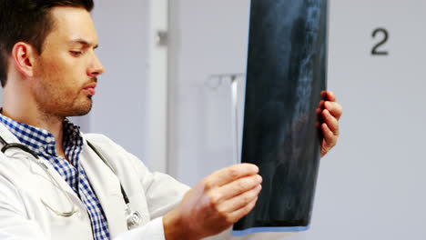 doctor examining x-ray report