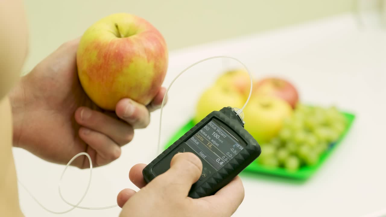 hombre diabético con una bomba de insulina conectada en su abdomen y sosteniendo la bomba de insulina en sus manos. concepto de diabetes.