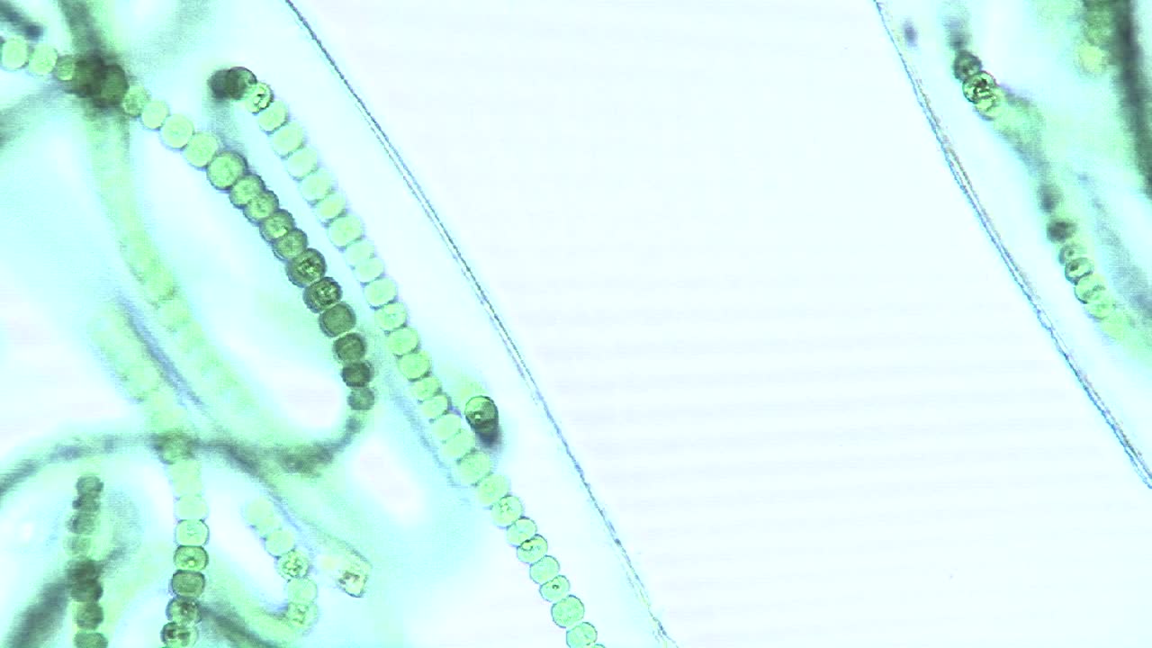 vista microscópica de sacos o burbujas que contienen cadenas de algas verdeazuladas 4