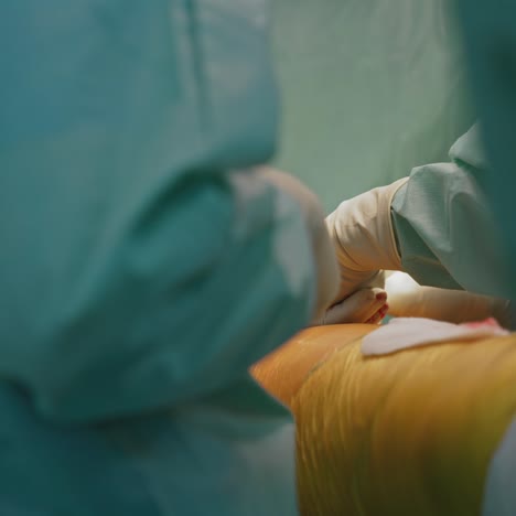 surgical process in the hospital. doctor's hands in gloves doing an operation to a sick patient with medical instruments. close-up
