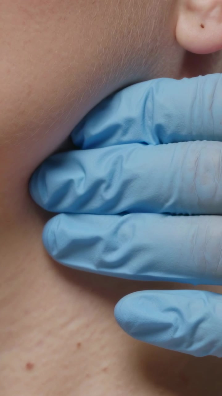 Video verticale: Mano guantata che palpa e si muove lungo la mascella o il collo in clinica per controllare i nei, guanto blu.