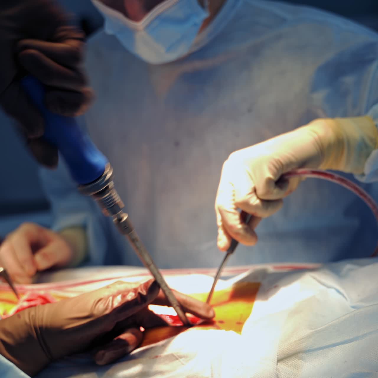 Professional neurosurgeons provide operation in modern operation room. Hands of doctors with futuristic equipment. Closeup
