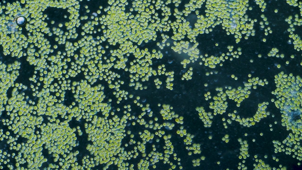 Cellule di alga clorella al microscopio in campo oscuro con ingrandimento 100x