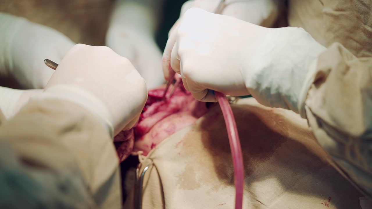 The process of carrying out a patient's surgery under general anesthesia using various medical instruments. Close-up. Facial surgery.