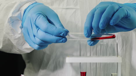 técnico en uniforme hace un análisis de sangre 1