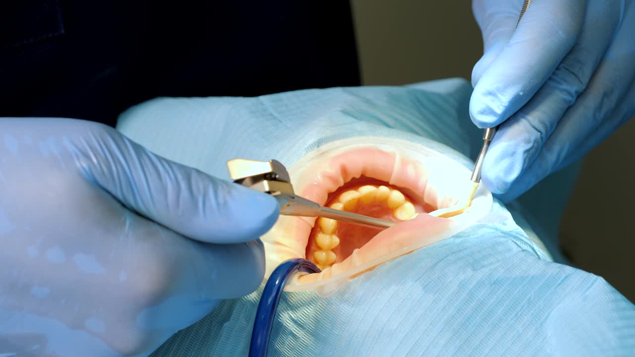 Dentist sprays water on tooth and assistant uses sucker during dental procedure. People, medicine, stomatology and health care concept. Close up view. 4k