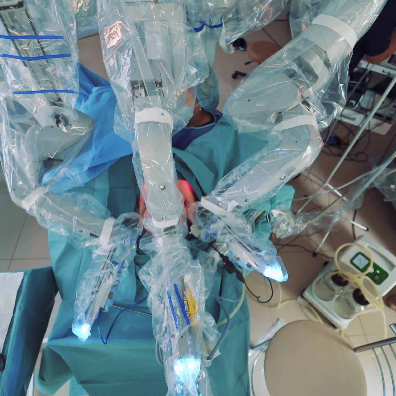 Modern surgical system. Medical robot. Minimally invasive robotic surgery.