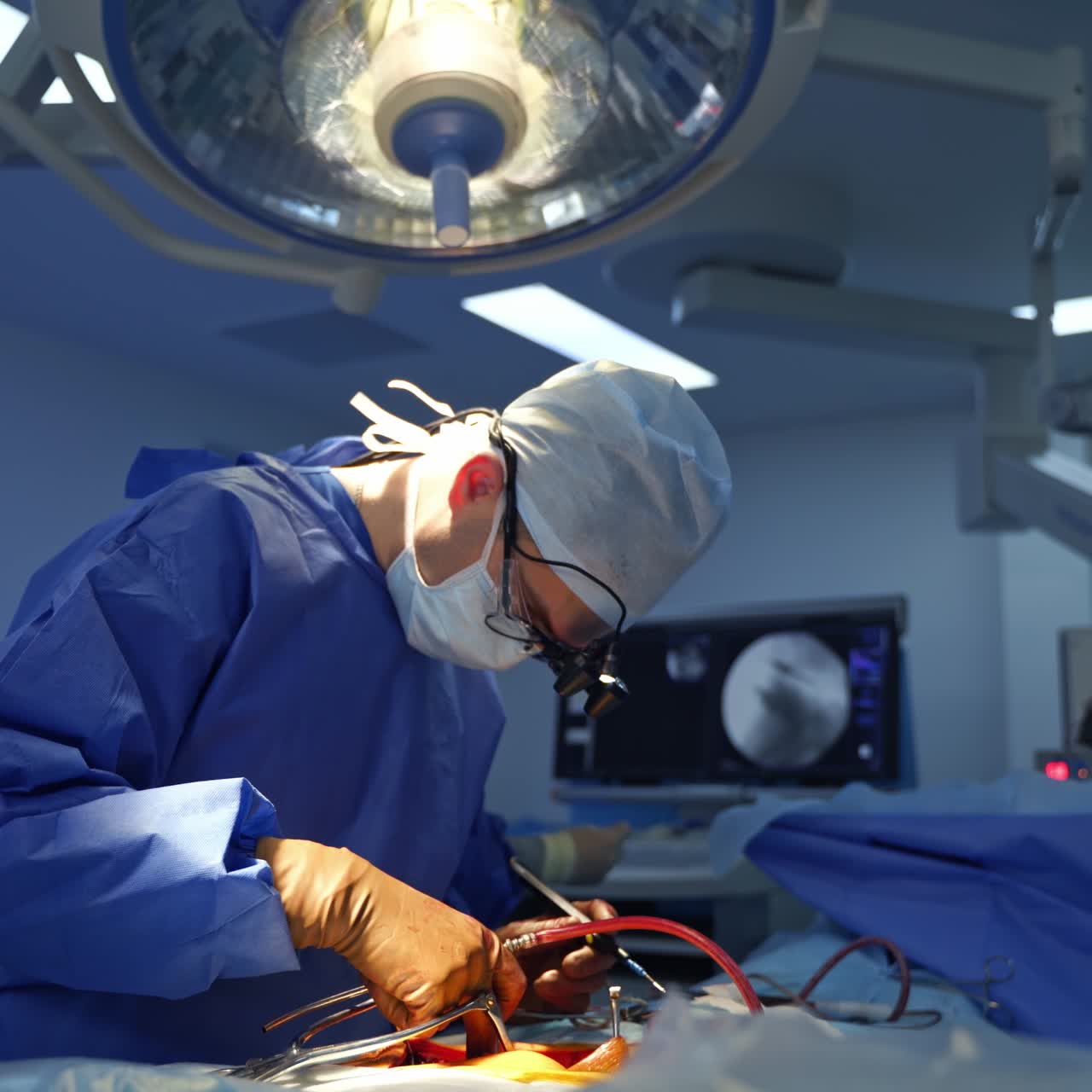 Surgical procedure in the operating room. Doctor with magnifying glasses on head conducts neurosurgery to a patient using sterile instruments