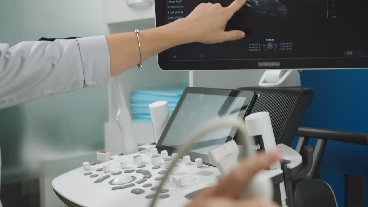 ecografía de una mujer embarazada