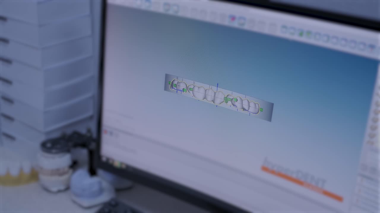 máquina de corte por cnc de coronas de zirconia a partir de circonia sin cocer