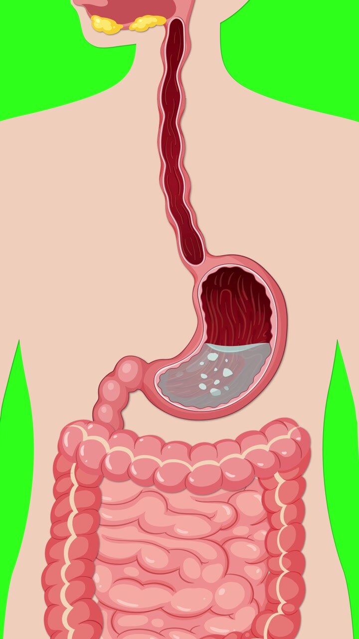 Vertical medical illustration showing gas bubbles forming in the stomach and intestines on green background.