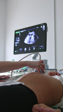 pregnant wife and her husband are at the doctor's cabinet. female doctor moving the sensor by the big belly of a woman. vertical video