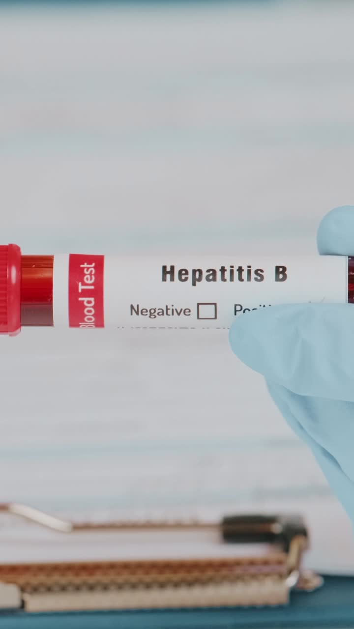 el médico realiza un análisis de sangre con una muestra de hepatitis b en un entorno clínico