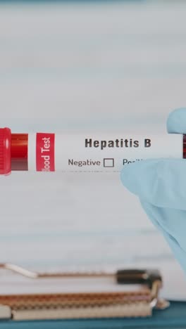 doctor conducts a blood test with hepatitis b sample in a clinical setting