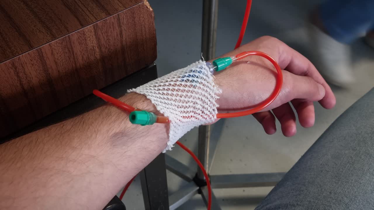 Nahaufnahme von Hand und Unterarm mit medizinischem Schlauch, der mit weißer Gaze befestigt ist
