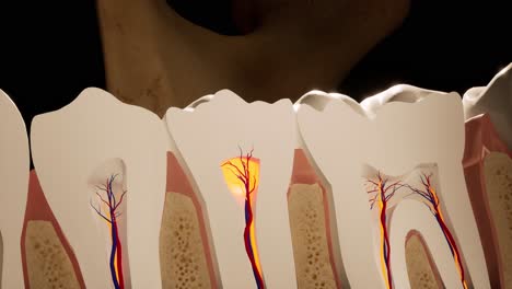 dolor de dientes. sección anatómica detallada de los dientes. inflamación del nervio. animación en 3d